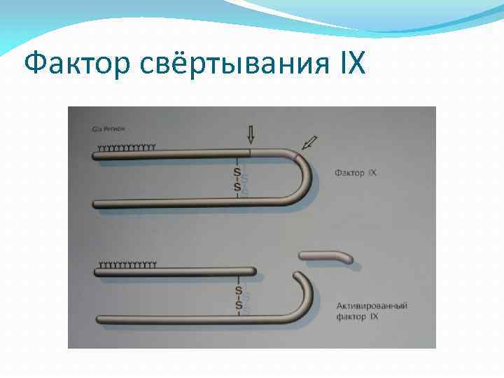 Фактор свёртывания IX 