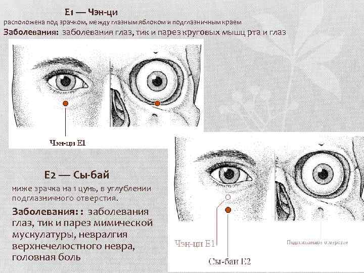 Е 1 — Чэн-ци расположена под зрачком, между глазным яблоком и подглазничным краем Заболевания: