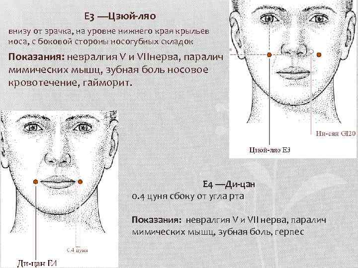 Е 3 —Цзюй-ляо внизу от зрачка, на уровне нижнего края крыльев носа, с боковой