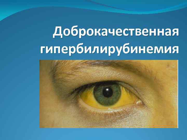 Доброкачественная гипербилирубинемия 