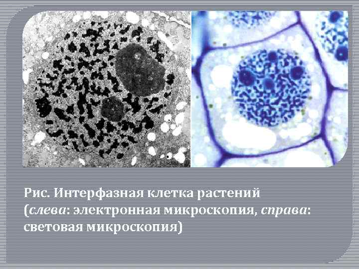 Рис. Интерфазная клетка растений (слева: электронная микроскопия, справа: световая микроскопия) 