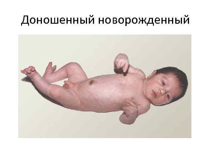 Доношенный новорожденный 