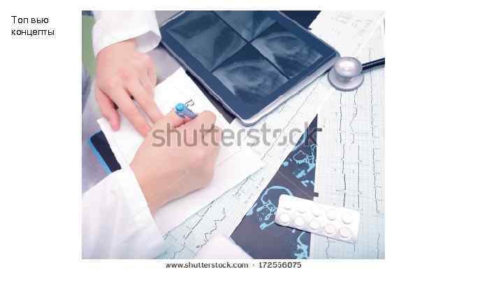 Топ вью концепты 