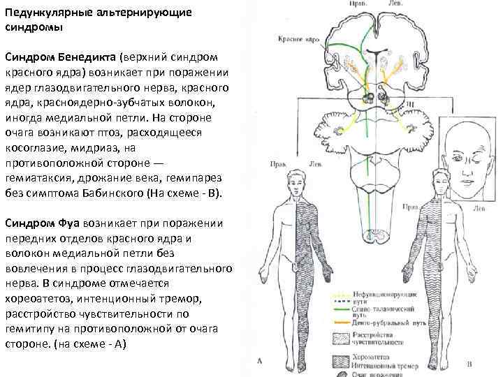 Синдром барде бидля презентация