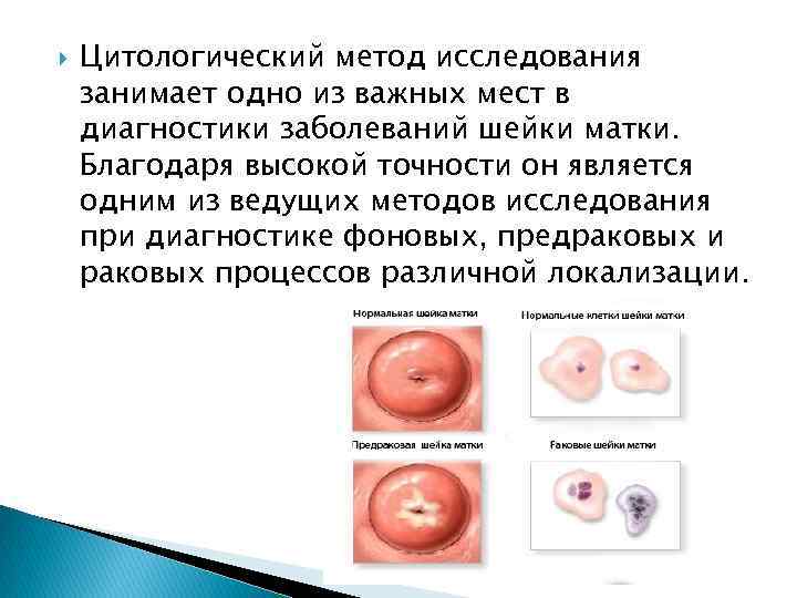  Цитологический метод исследования занимает одно из важных мест в диагностики заболеваний шейки матки.