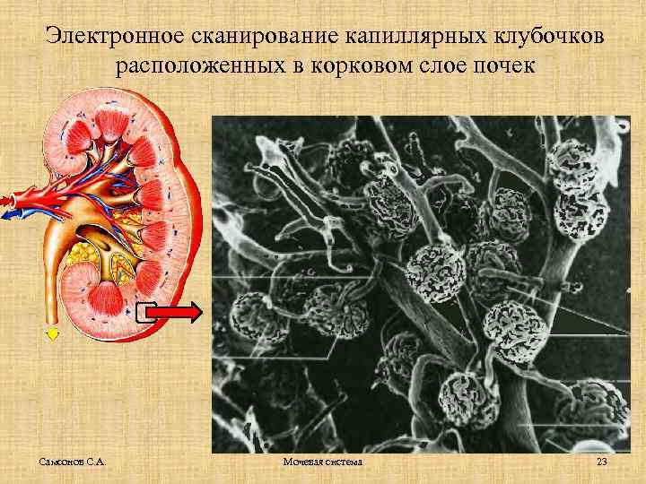 Электронное сканирование капиллярных клубочков расположенных в корковом слое почек Самсонов С. А. Мочевая система