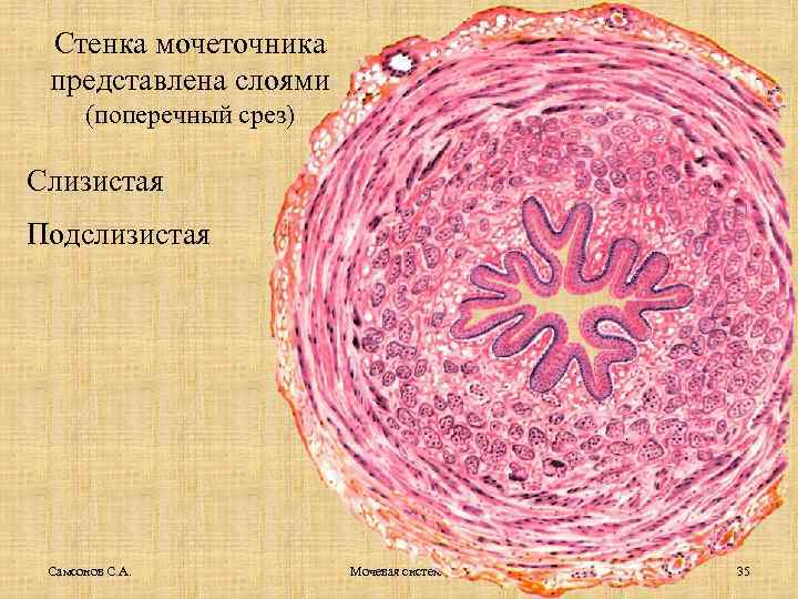 Стенка мочеточника представлена слоями (поперечный срез) Слизистая Подслизистая Самсонов С. А. Мочевая система 35