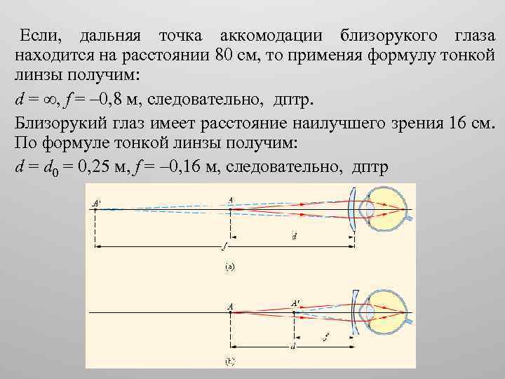 Дальше точки. Дальняя точка аккомодации. Дальняя точка глаза. Дальняя и Ближняя точка аккомодации. Аккомодация глаза точки на расстоянии.