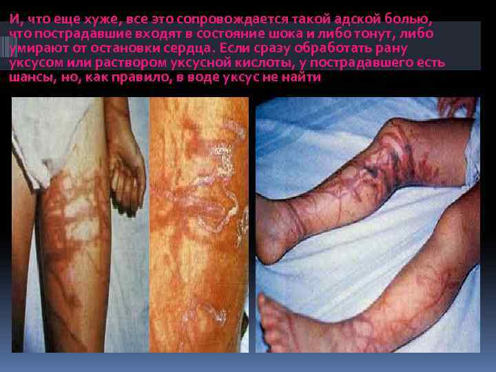 И, что еще хуже, все это сопровождается такой адской болью, что пострадавшие входят в