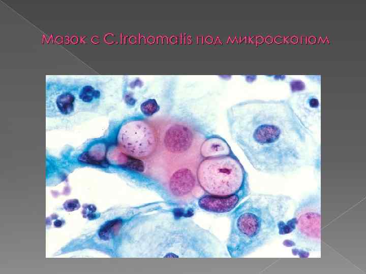 Мазок с C. trahomatis под микроскопом 