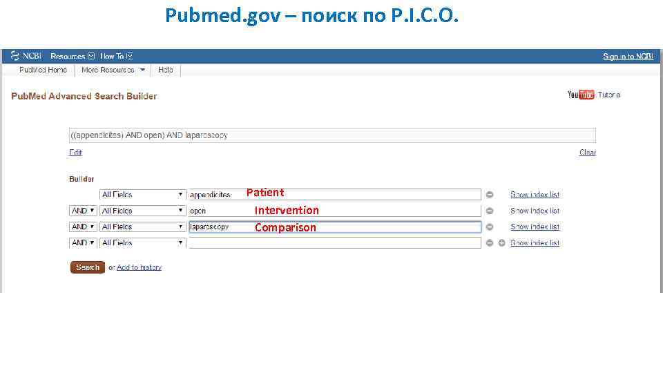 Pubmed. gov – поиск по P. I. C. O. Patient Intervention Comparison 