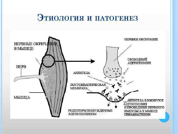 ЭТИОЛОГИЯ И ПАТОГЕНЕЗ 