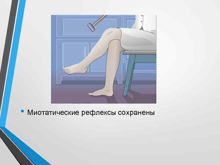  • Миотатические рефлексы сохранены 