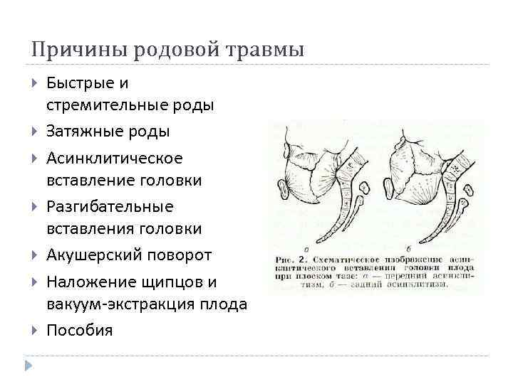 Причины родовой травмы Быстрые и стремительные роды Затяжные роды Асинклитическое вставление головки Разгибательные вставления