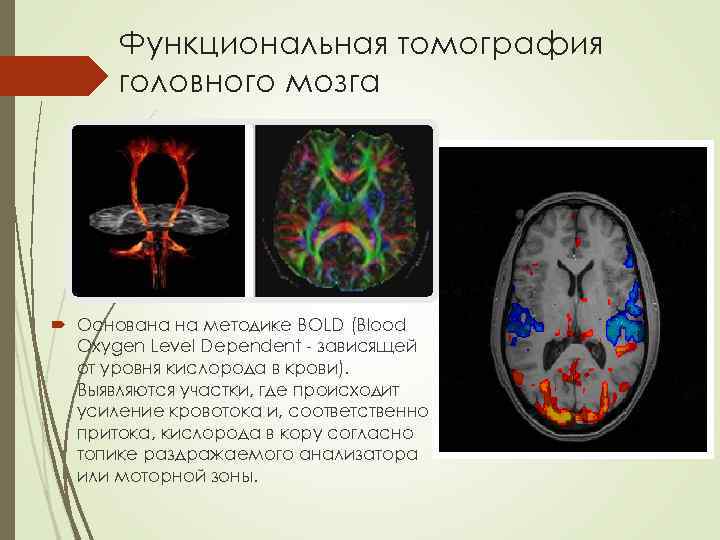 Функциональная томография головного мозга Основана на методике BOLD (Blood Oxygen Level Dependent - зависящей