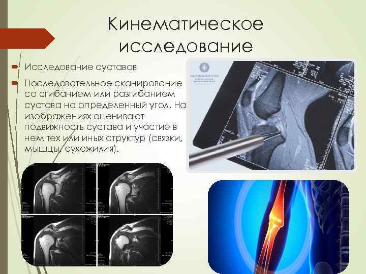 Кинематическое исследование Исследование суставов Последовательное сканирование со сгибанием или разгибанием сустава на определенный угол.