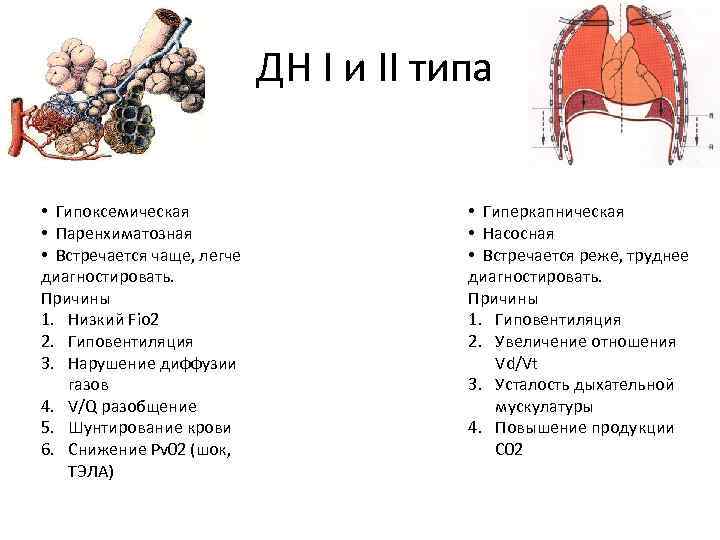 ДН I и II типа • Гипоксемическая • Паренхиматозная • Встречается чаще, легче диагностировать.