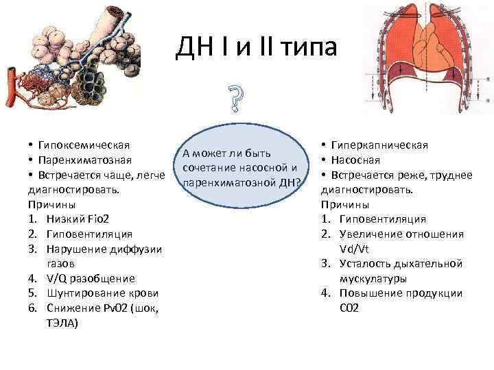 ДН I и II типа ? • Гипоксемическая • Паренхиматозная • Встречается чаще, легче