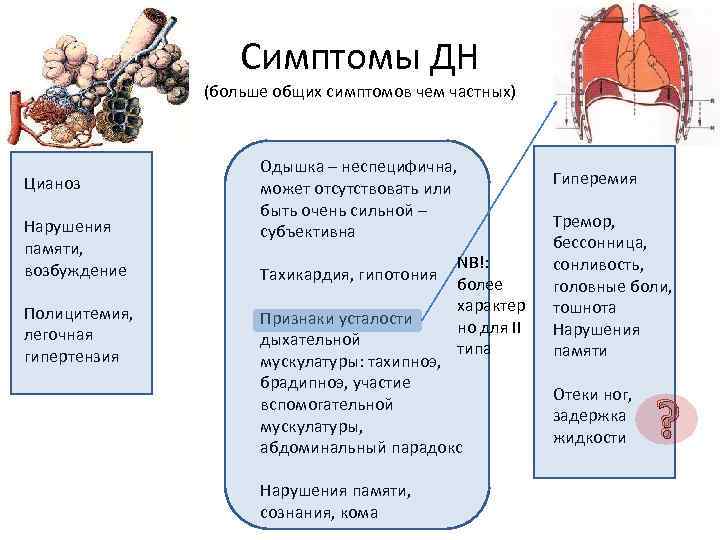 Симптомы ДН (больше общих симптомов чем частных) Цианоз Нарушения памяти, возбуждение Полицитемия, легочная гипертензия