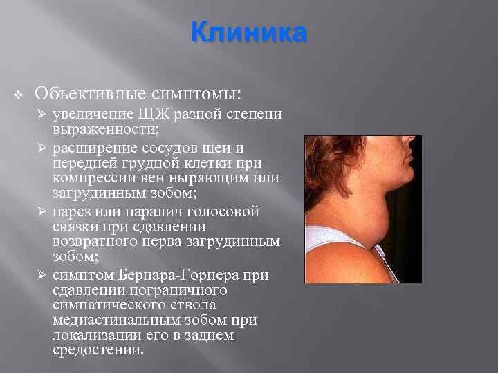 Клиника v Объективные симптомы: увеличение ЩЖ разной степени выраженности; Ø расширение сосудов шеи и