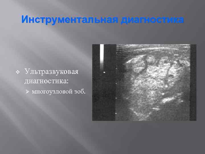 Инструментальная диагностика v Ультразвуковая диагностика: Ø многоузловой зоб. 
