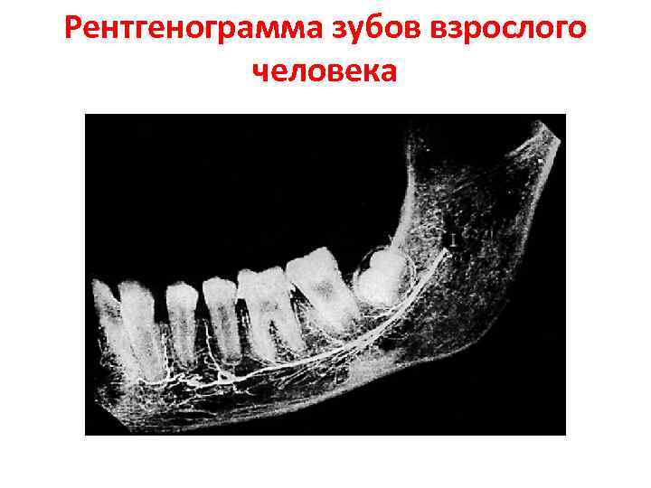 Рентгенограмма зубов взрослого человека 