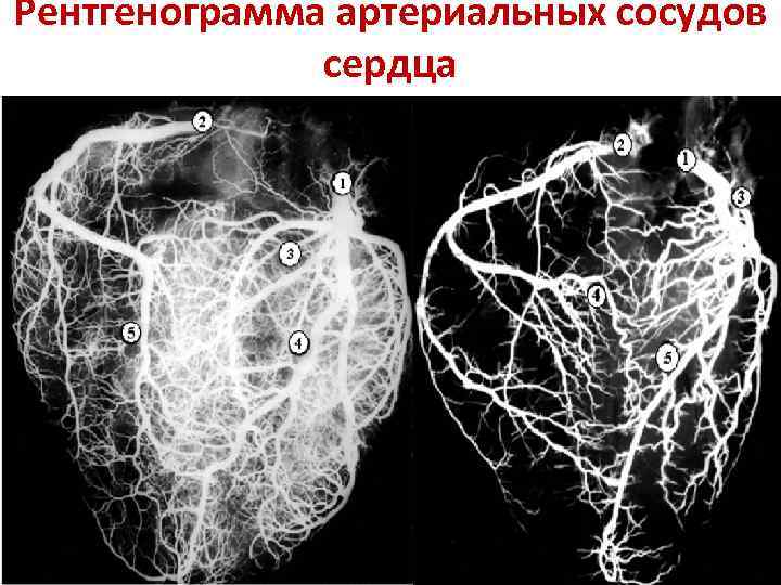 Компьютерная ангиография сосудов сердца где сделать