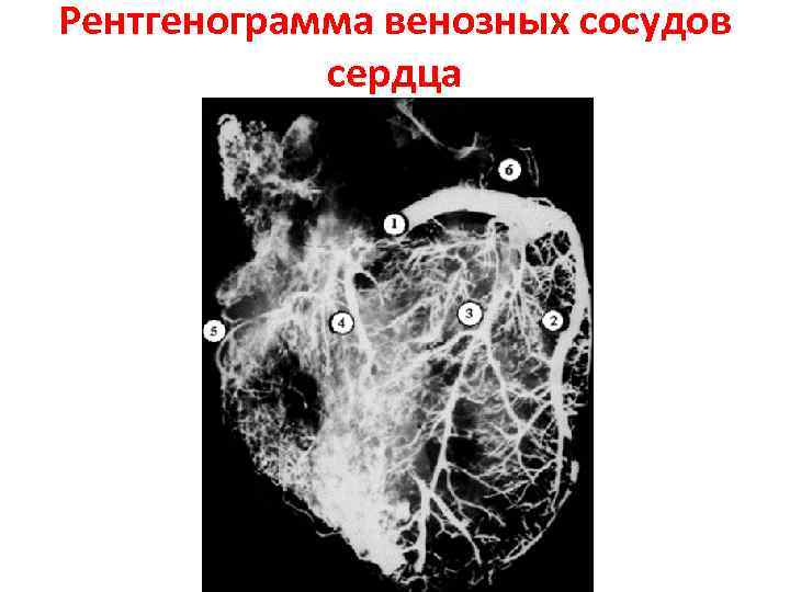 Компьютерная ангиография сосудов сердца где сделать