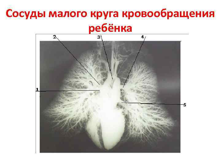 Сосуды малого круга кровообращения ребёнка 