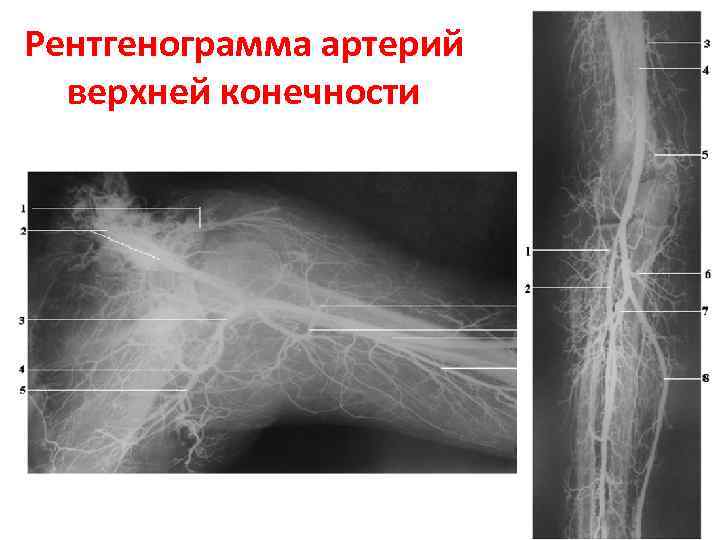 Схема описания рентгенограммы костей