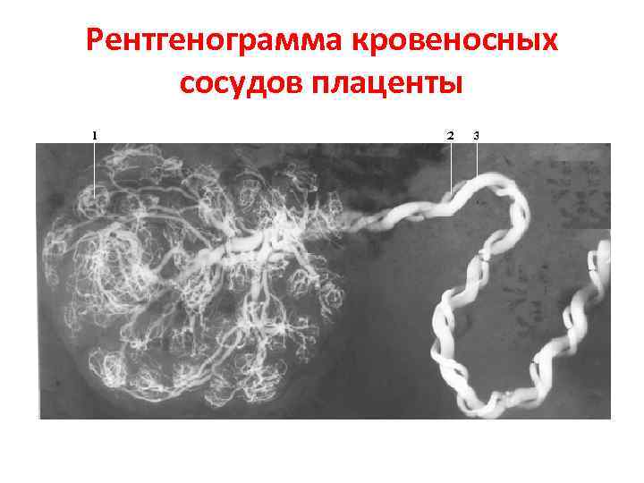 Рентгенограмма кровеносных сосудов плаценты 