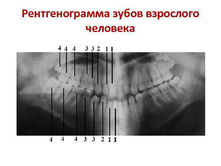 Рентгенограмма зубов взрослого человека 