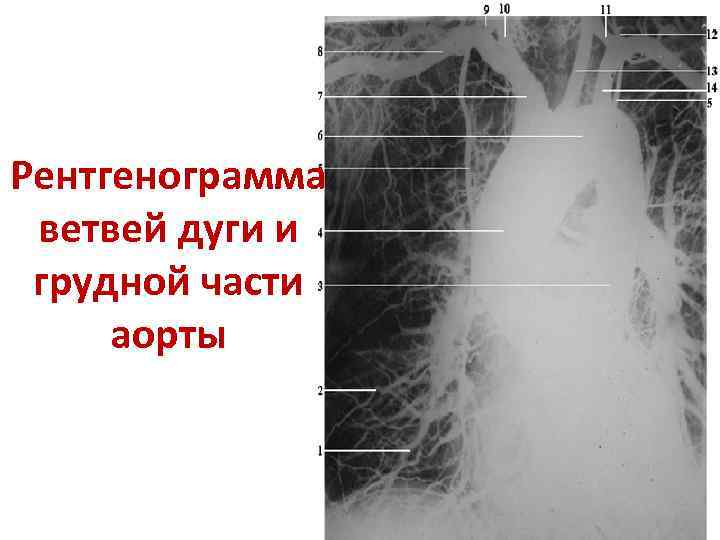 Описание рентгенограммы схема