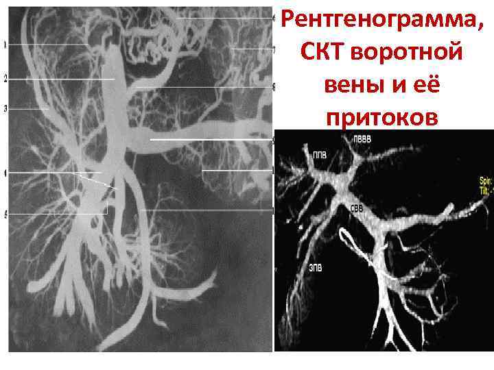 Описание рентгенограммы схема