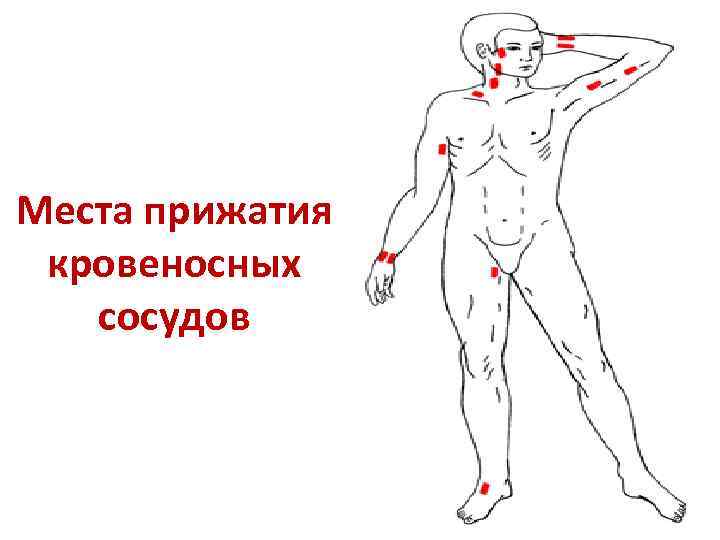 Места прижатия кровеносных сосудов 