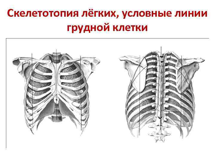 Рахитическая грудная клетка рисунок схематично