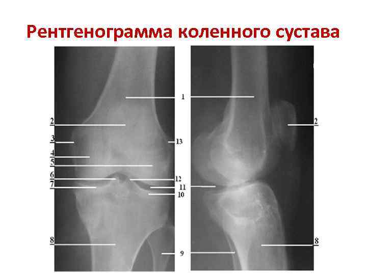 Рентген Коленного Сустава Цена