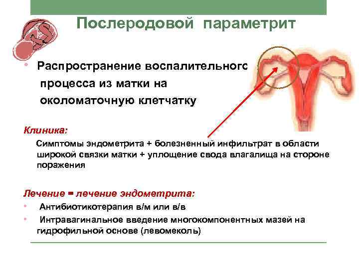 Послеродовой параметрит • Распространение воспалительного процесса из матки на околоматочную клетчатку Клиника: Симптомы эндометрита