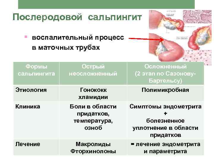 Послеродовой сальпингит § воспалительный процесс в маточных трубах Формы сальпингита Острый неосложненный Осложненный (2