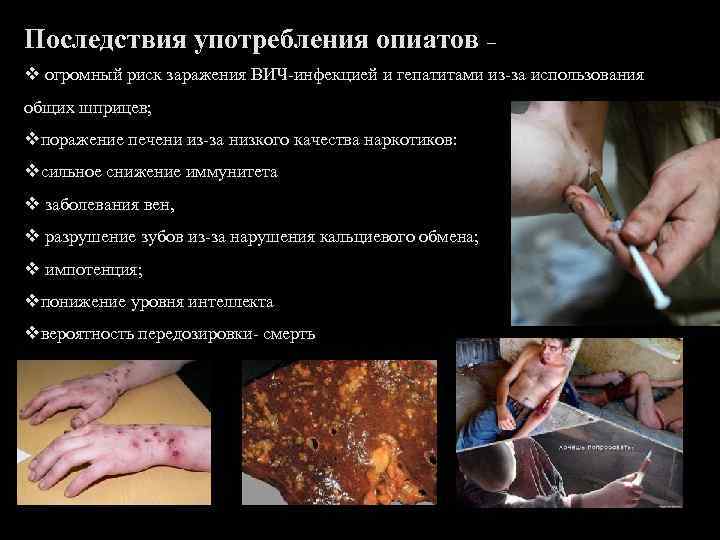 Последствия употребления опиатов – v огромный риск заражения ВИЧ-инфекцией и гепатитами из-за использования общих