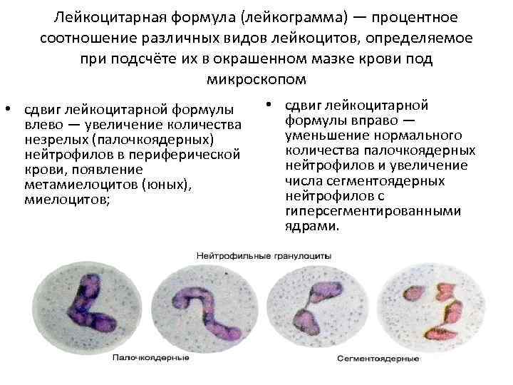 Лейкоцитарная формула (лейкограмма) — процентное соотношение различных видов лейкоцитов, определяемое при подсчёте их в