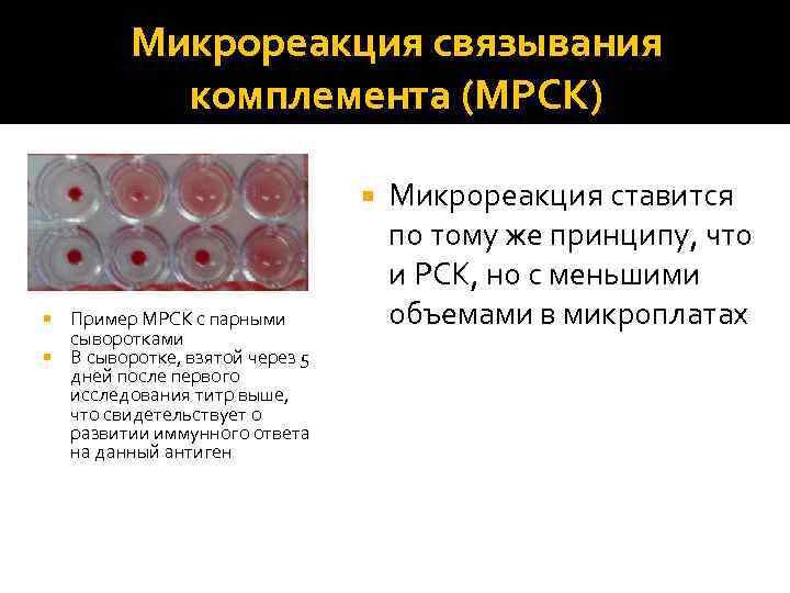 Микрореакция связывания комплемента (МРСК) Пример МРСК с парными сыворотками В сыворотке, взятой через 5