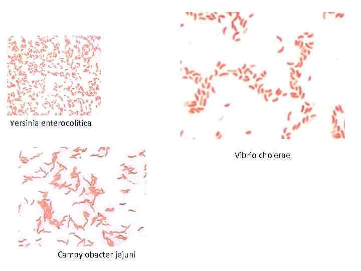 Yersinia enterocolitica Vibrio cholerae Campylobacter jejuni 