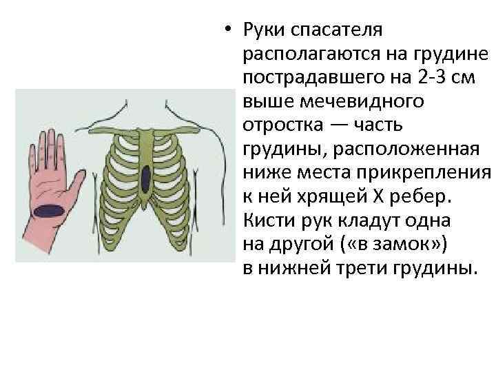 Мечевидный отросток грудины. Место соприкосновения руки и грудины при непрямом массаже сердца. Мечевидный отросток у младенца. Пульсация под мечевидным отростком.