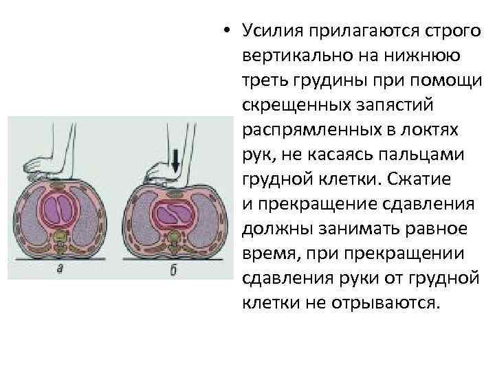 Нижняя треть грудины