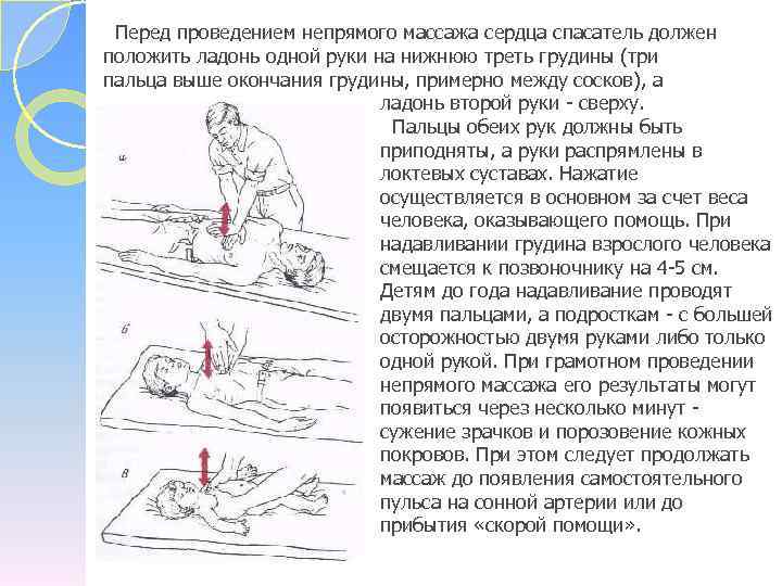  Перед проведением непрямого массажа сердца спасатель должен положить ладонь одной руки на нижнюю