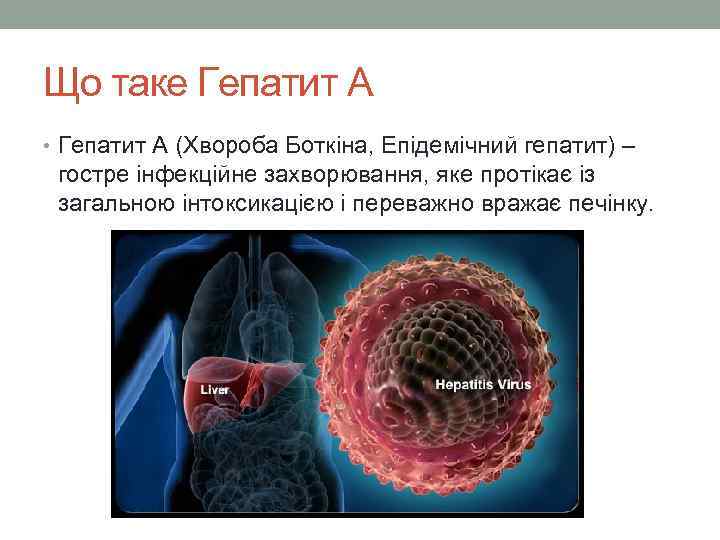 Що таке Гепатит А • Гепатит А (Хвороба Боткіна, Епідемічний гепатит) – гостре інфекційне