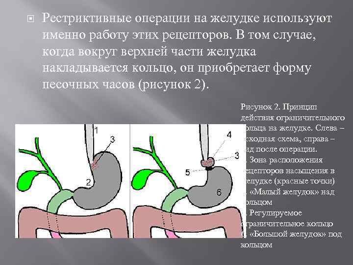  Рестриктивные операции на желудке используют именно работу этих рецепторов. В том случае, когда