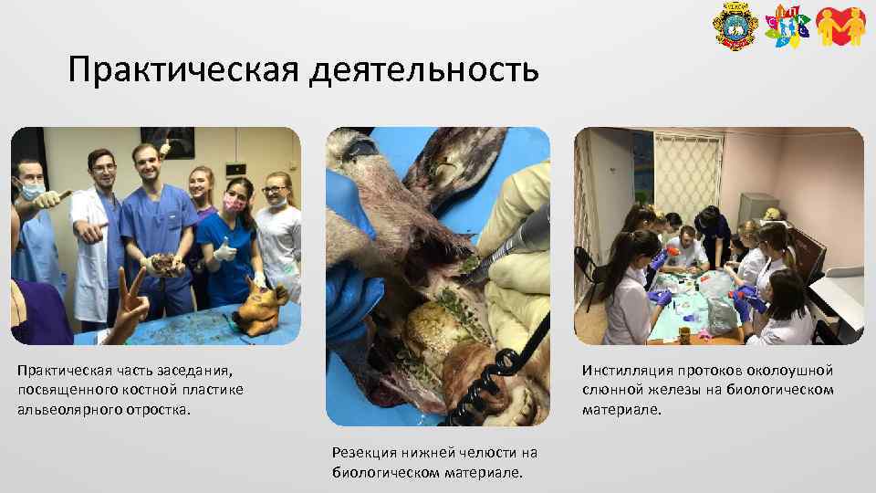 Практическая деятельность Практическая часть заседания, посвященного костной пластике альвеолярного отростка. Инстилляция протоков околоушной слюнной