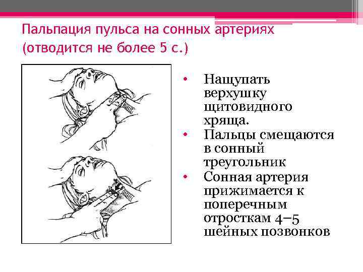 Пальпация пульса на сонных артериях (отводится не более 5 с. ) • • •